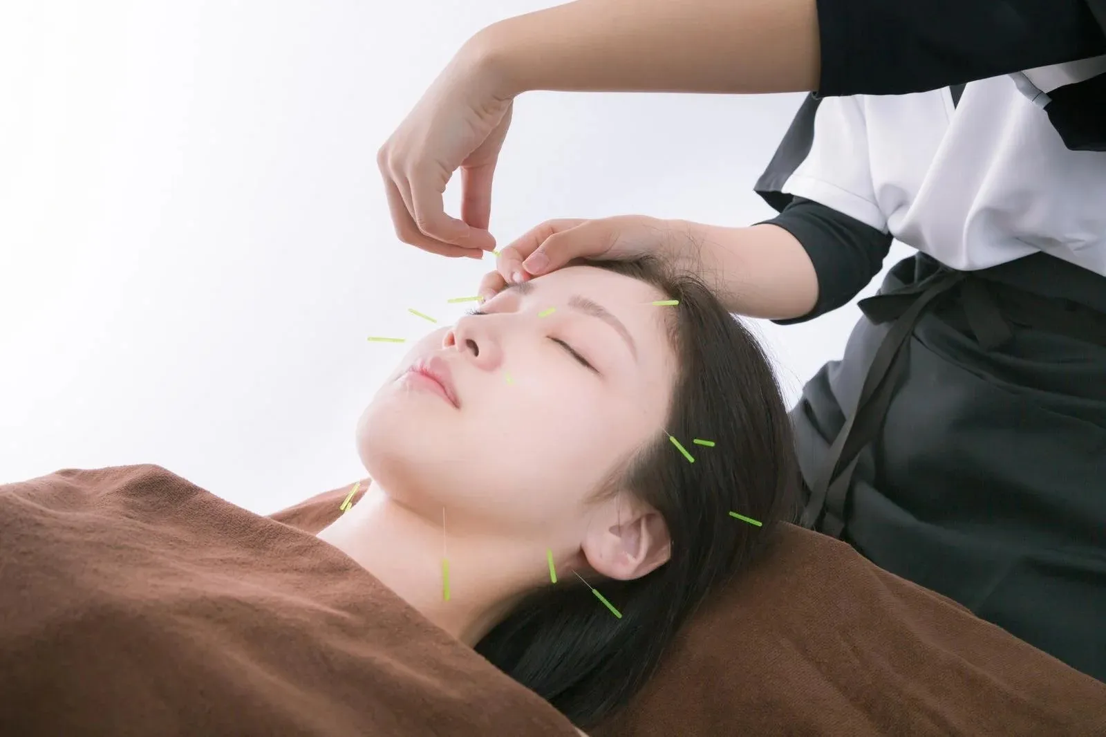 美容と健康を同時に手に入れる！鍼灸院での美顔鍼の効果と魅力